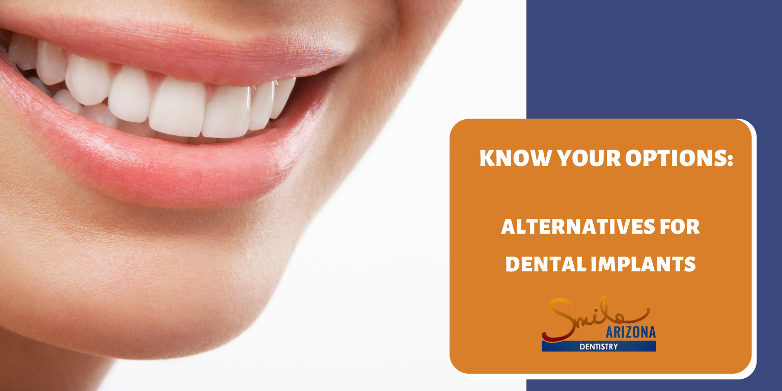 Know Your Options: Alternatives for Dental Implants