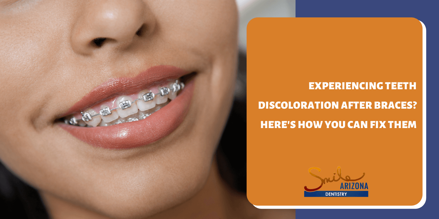 Do You Know The Parts Of Your Braces? (And Why It's Important)